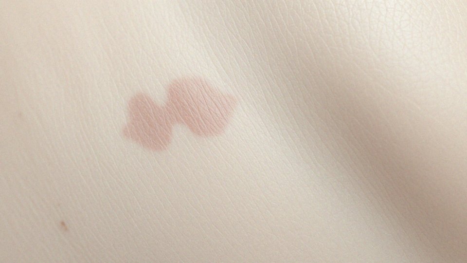 Jakie są różnice między czerwonymi a białymi rozstępami?